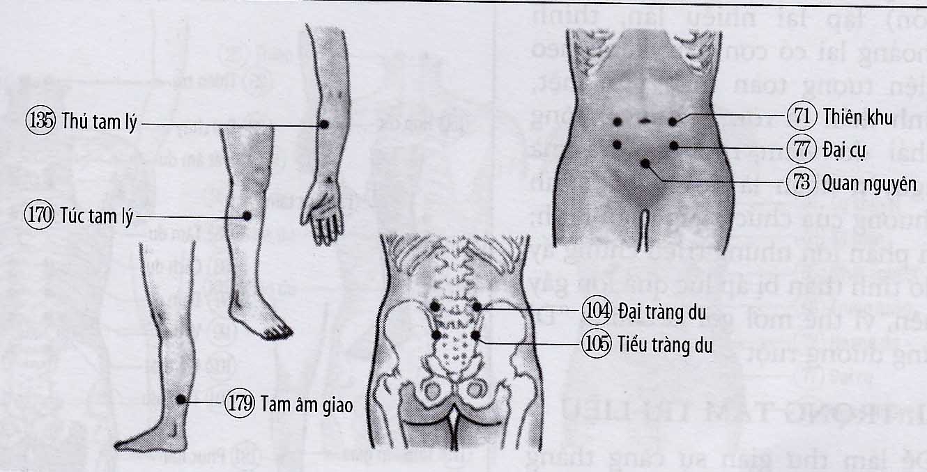 Viêm ruột mạn tính