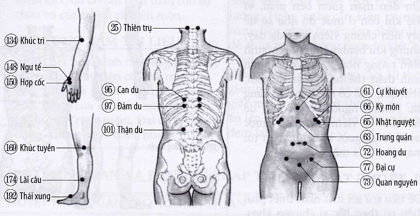 Viêm gan mạn tính