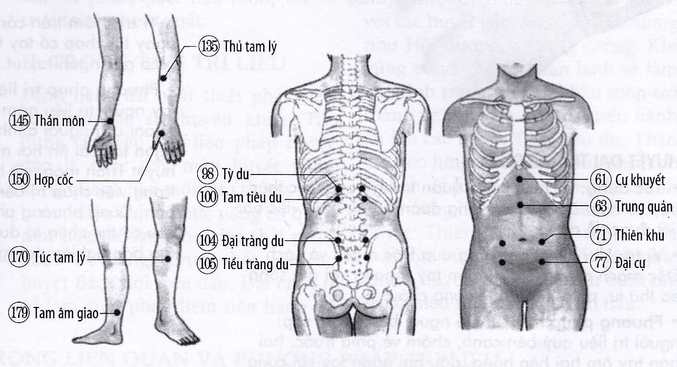 Bí đại tiện