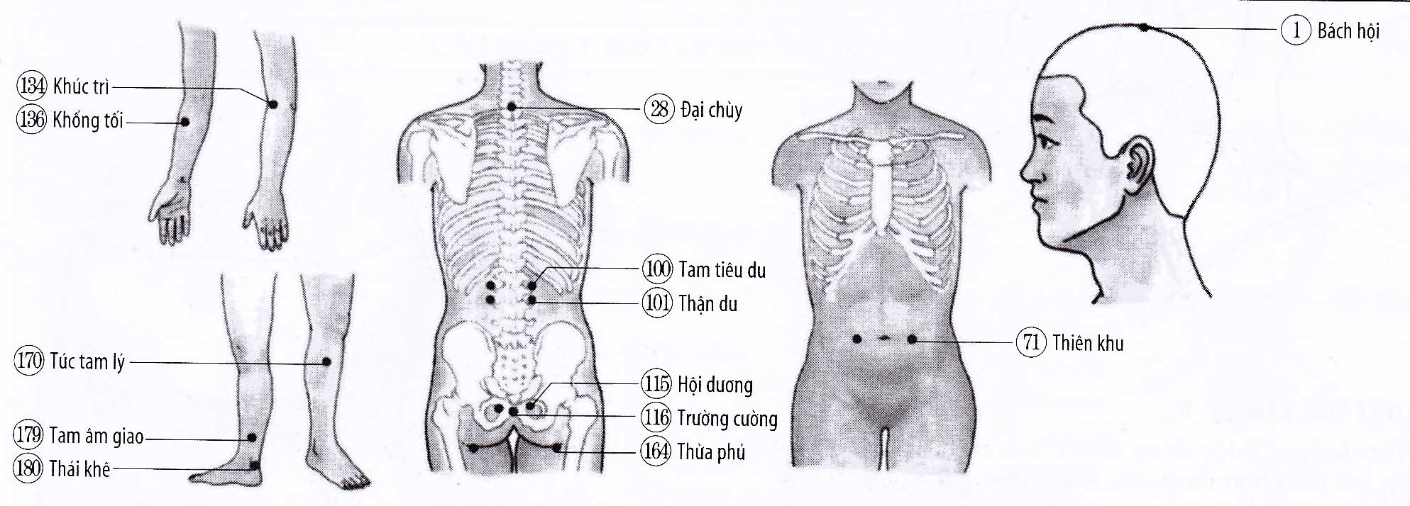 Bệnh trĩ, trĩ ngoại, trực tràng thoát xuất