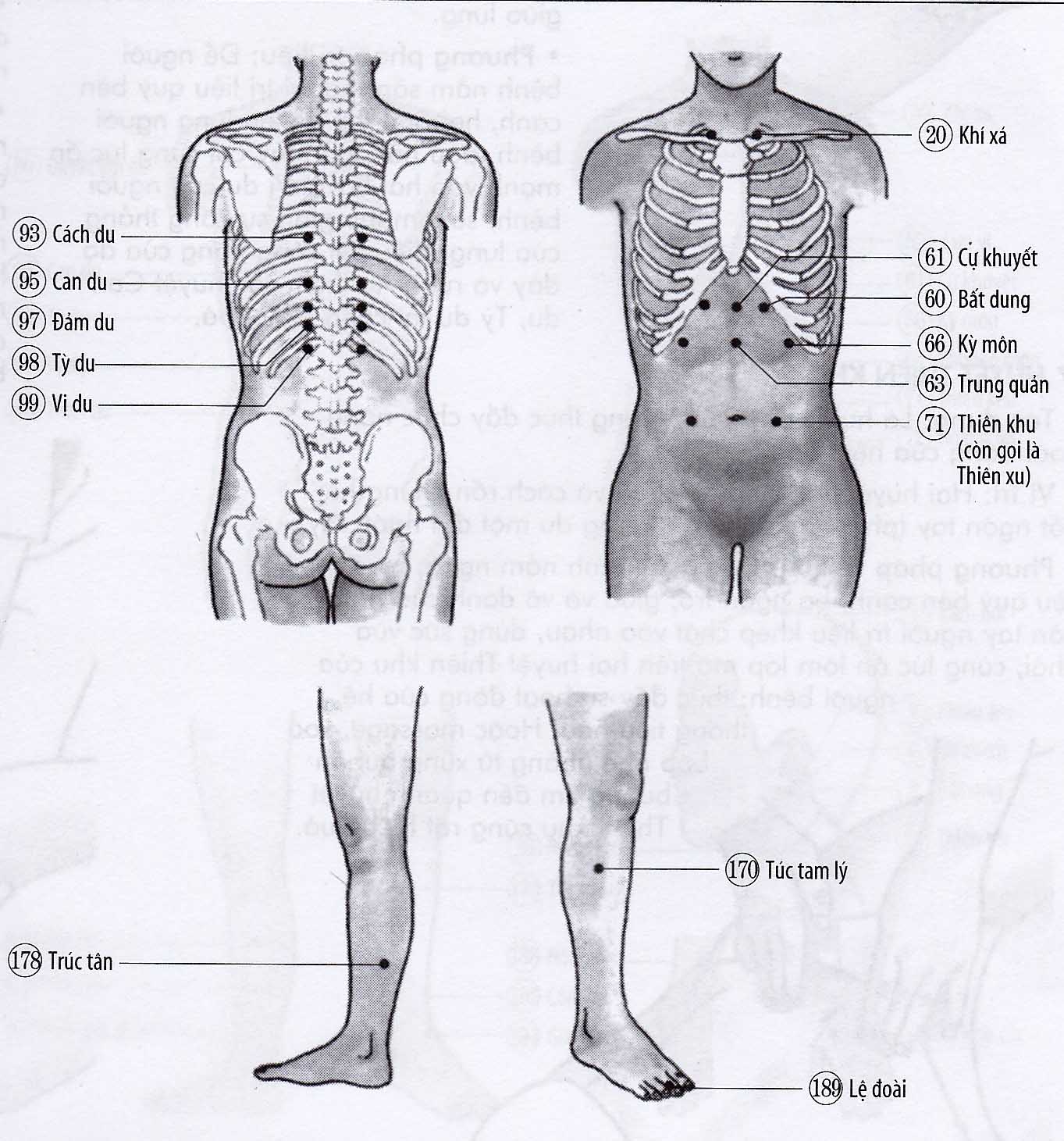 Chứng buồn nôn, ói mửa