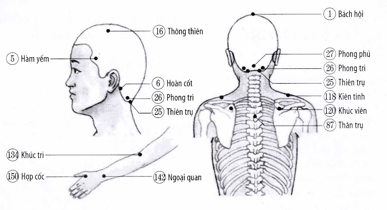 Đau thần kinh sau đầu