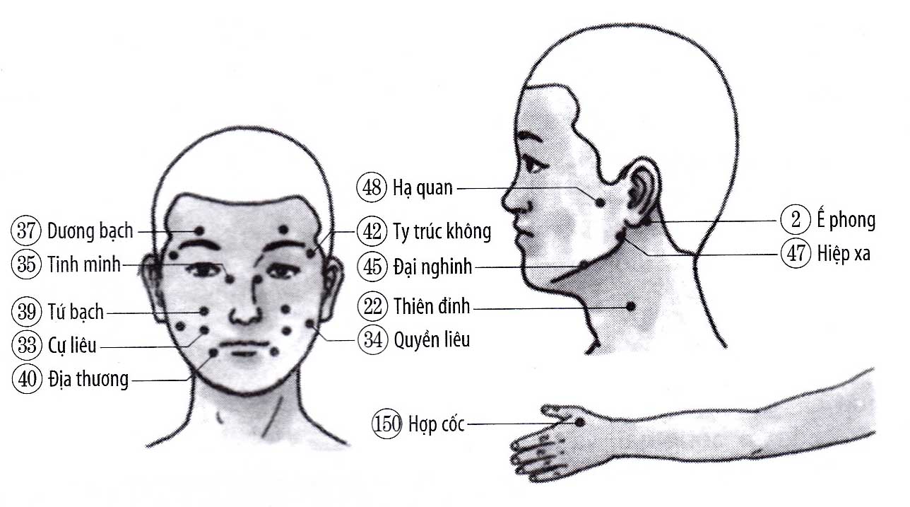 Đau mặt, đau đôi thần kinh não thứ 5
