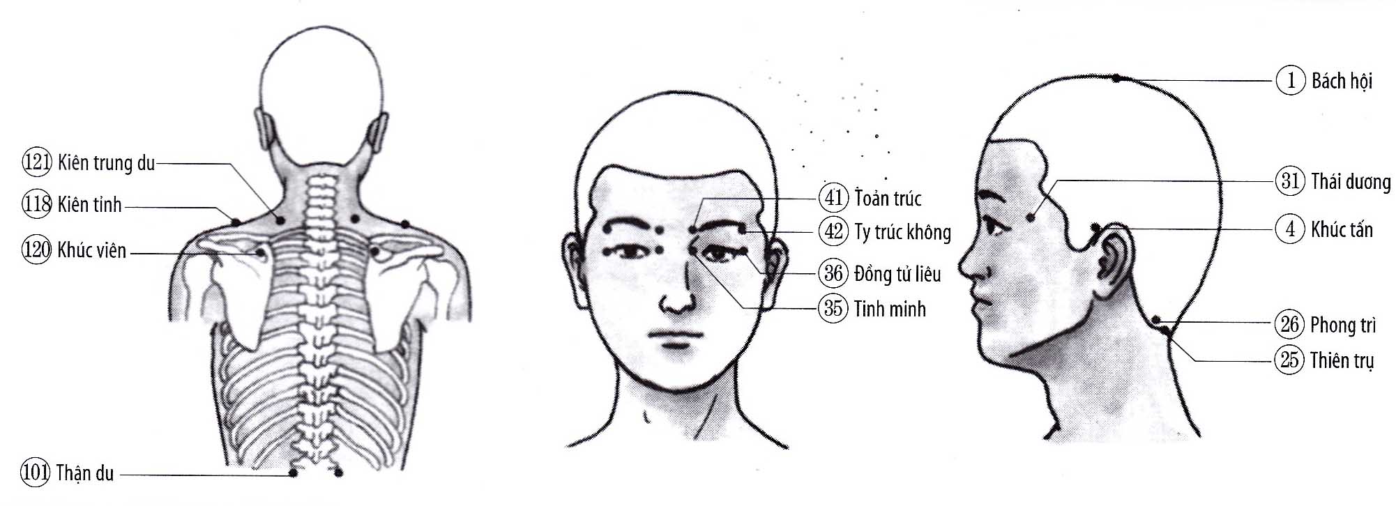 Chứng đau nhức mắt