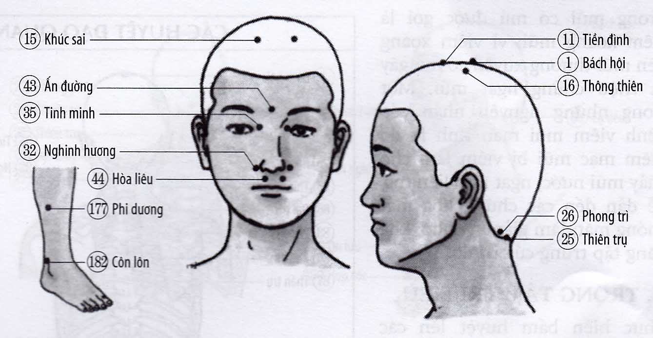 Chứng ngạt mũi, sổ mũi