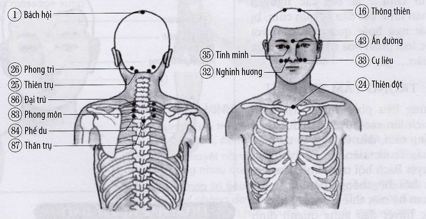 Chứng viêm mũi mạn tính, mũi tích mủ