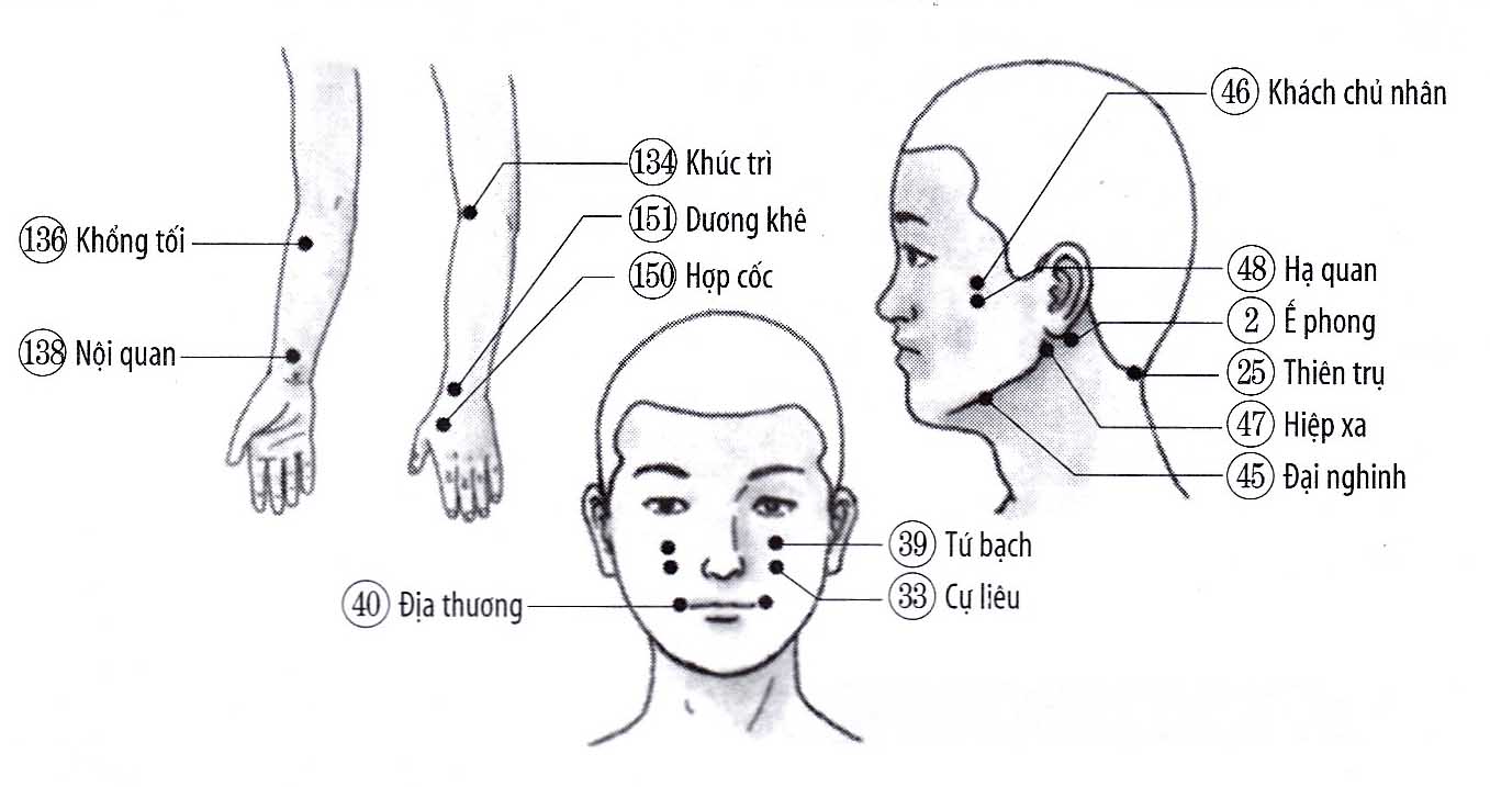 Bệnh đau răng