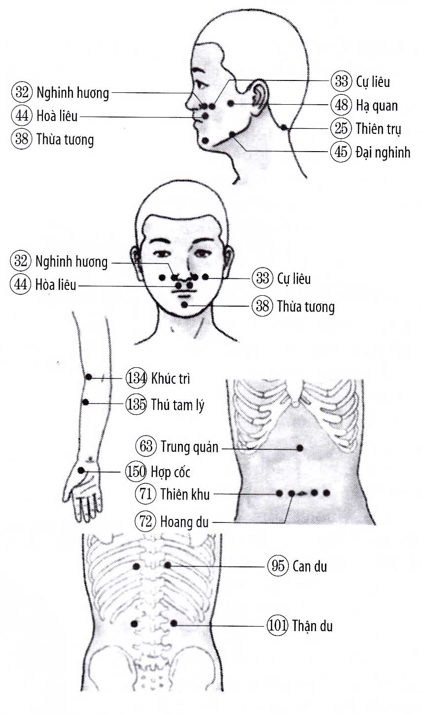 Đau lợi răng