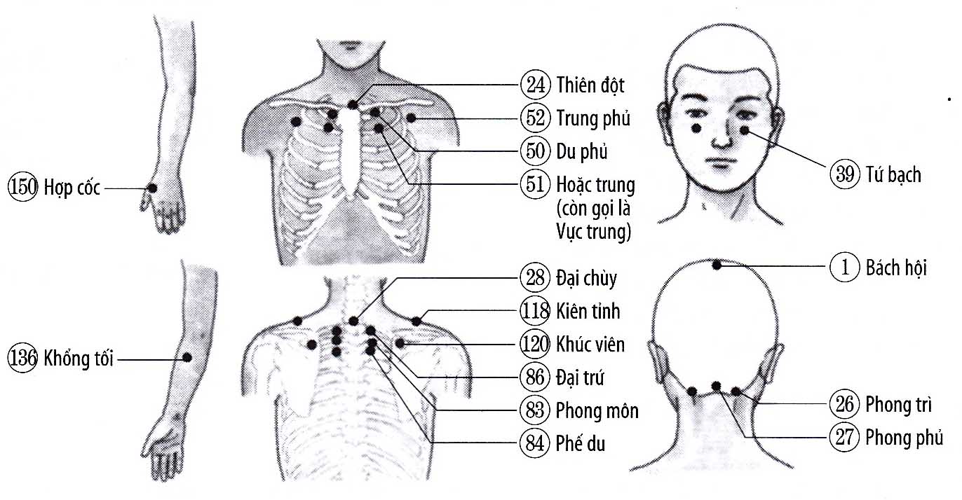 Triệu chứng cảm cúm