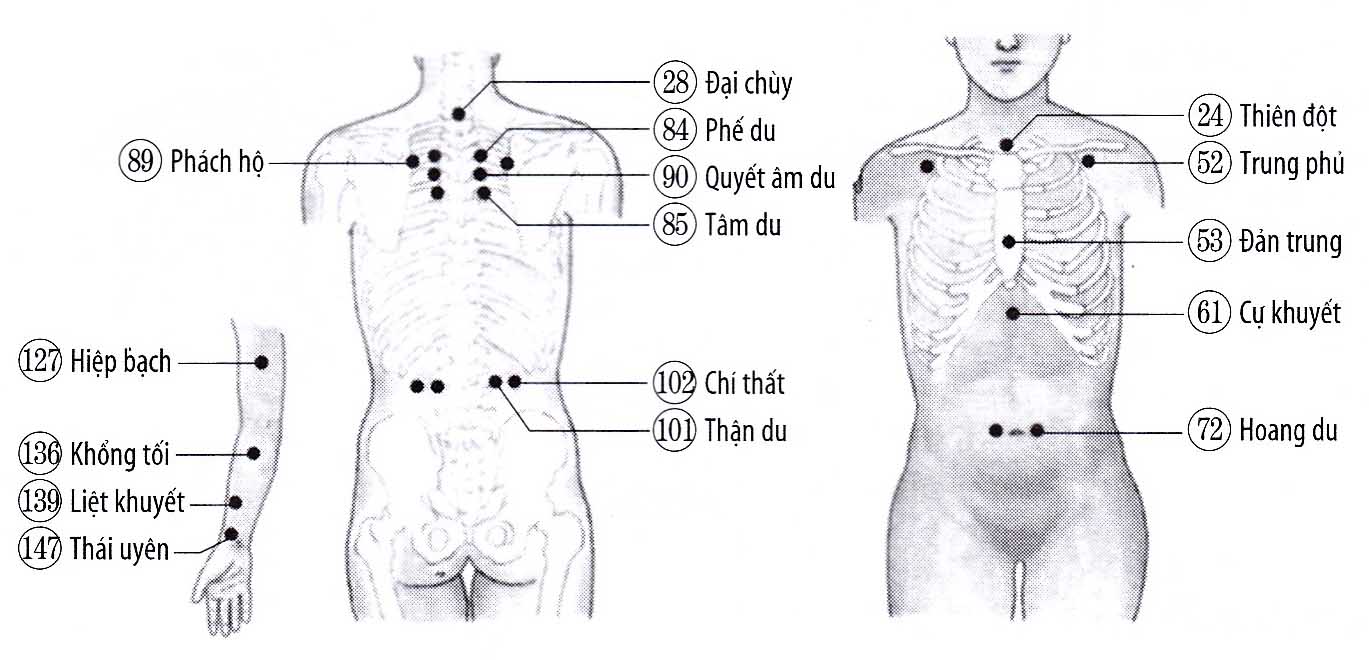 Viêm phế quản mạn tính