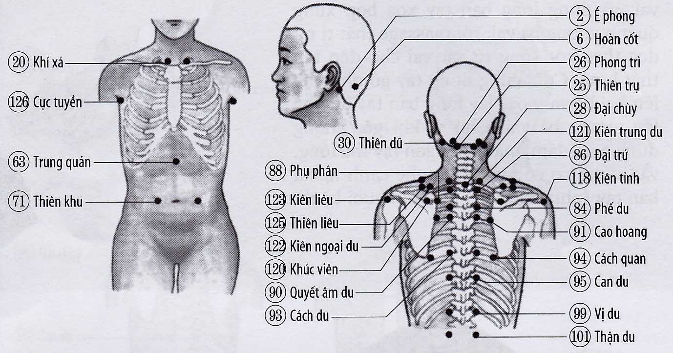 Nhức mỏi và đau cổ, vai