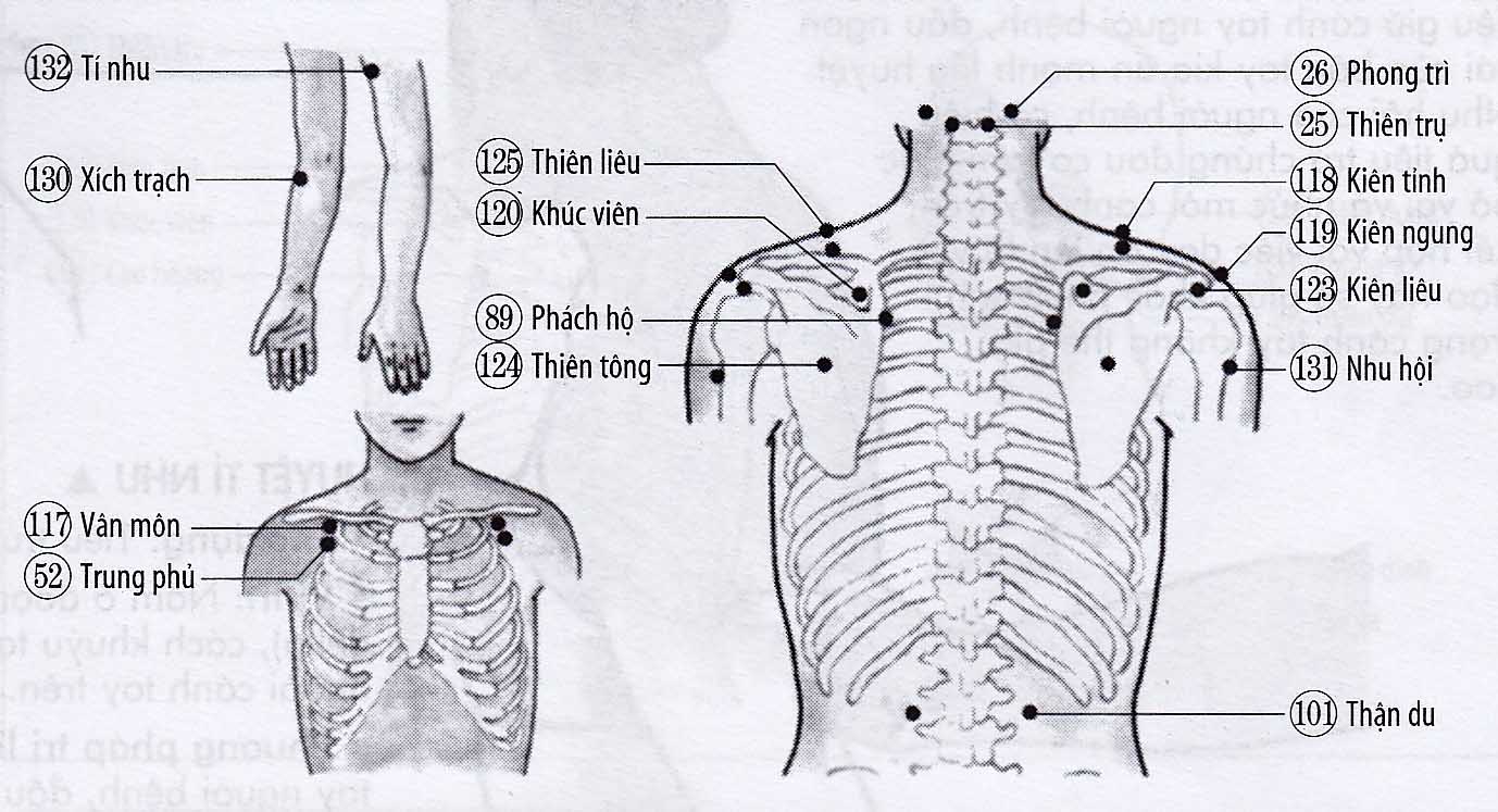 Viêm khớp xương vai