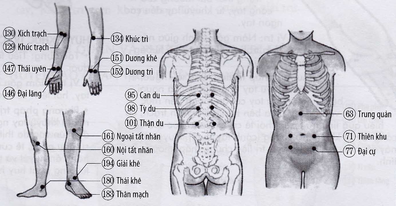 Thấp khớp mạn tính
