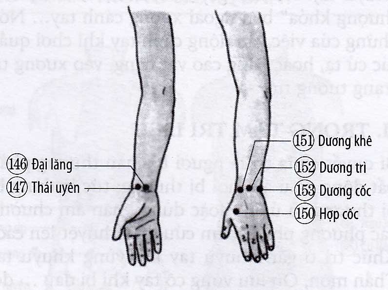 Chứng trẹo cổ tay, vẹo ngón tay