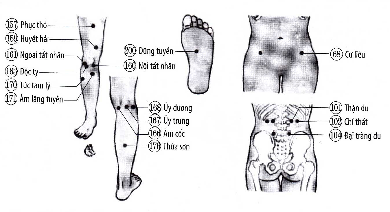Đau nhức đầu gối