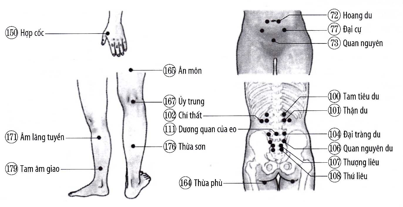 Chứng biến dạng cột sống lưng
