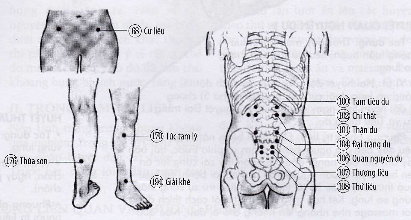 Đau lưng cấp tính