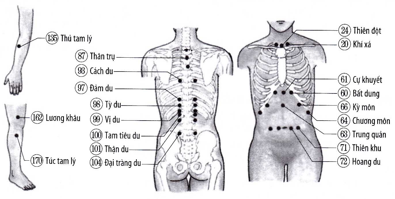 Chứng ngực nóng ran, nấc cụt (do yếu dạ dày)