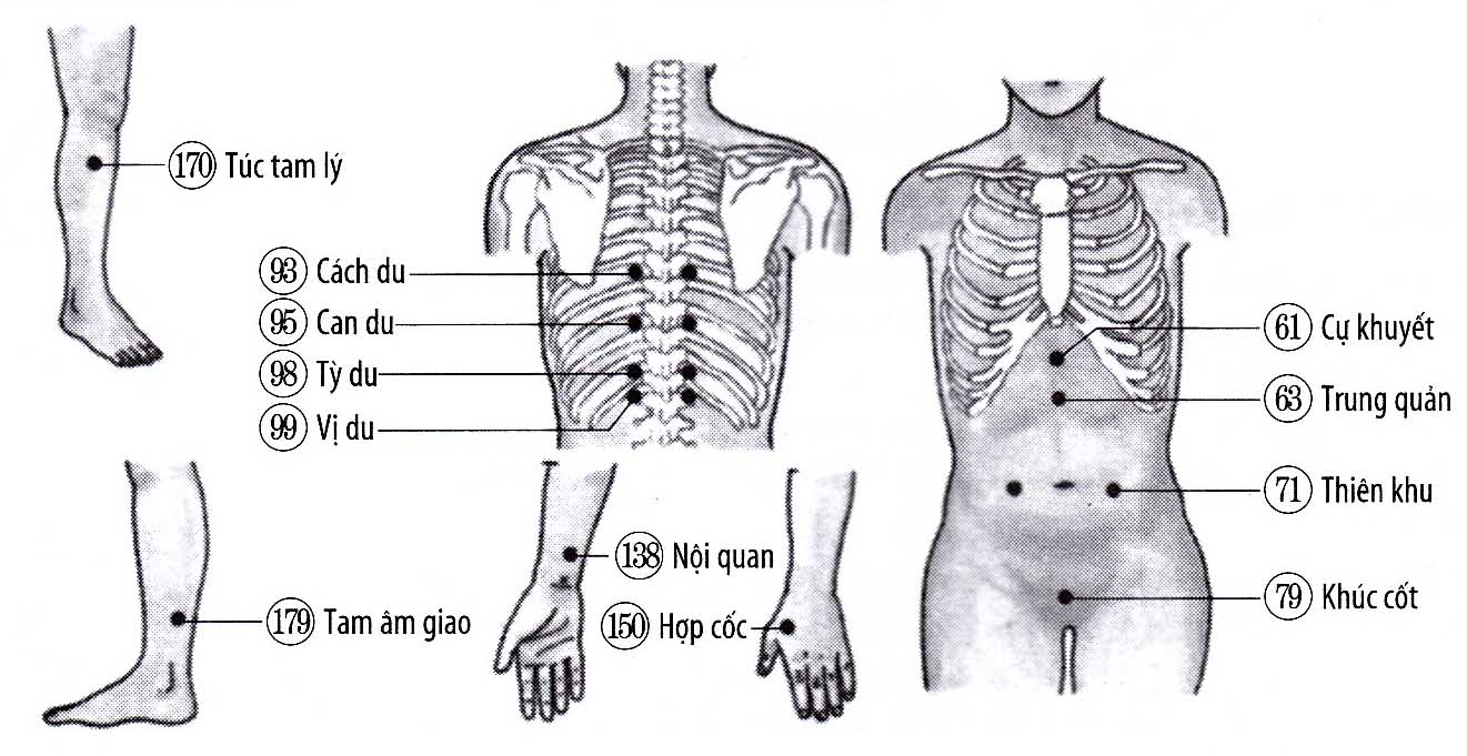 Viêm dạ dày mạn tính